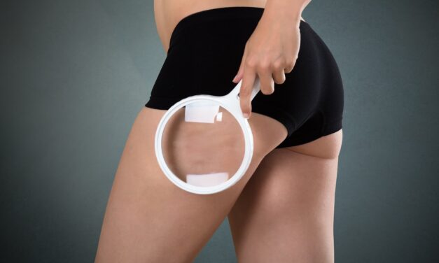 Cellulit – skąd się bierze?