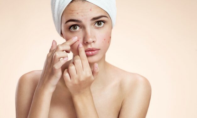 Skuteczne sposoby na trądzik